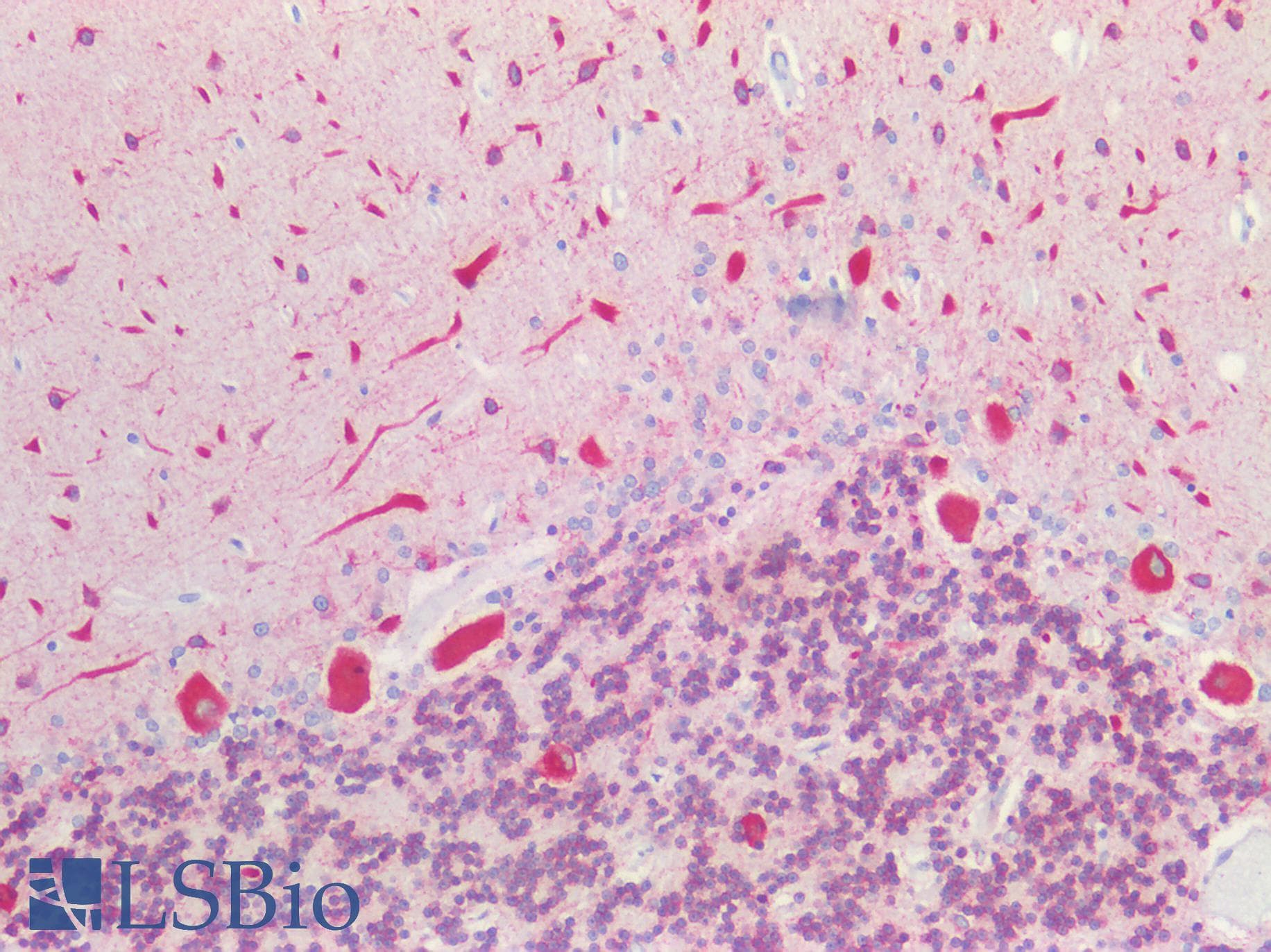 PathPlus™ CANX / Calnexin Antibody