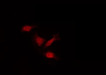 LIMK2 Antibody (phospho-Ser283)