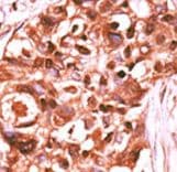 STAT5A Antibody (phospho-Tyr694)