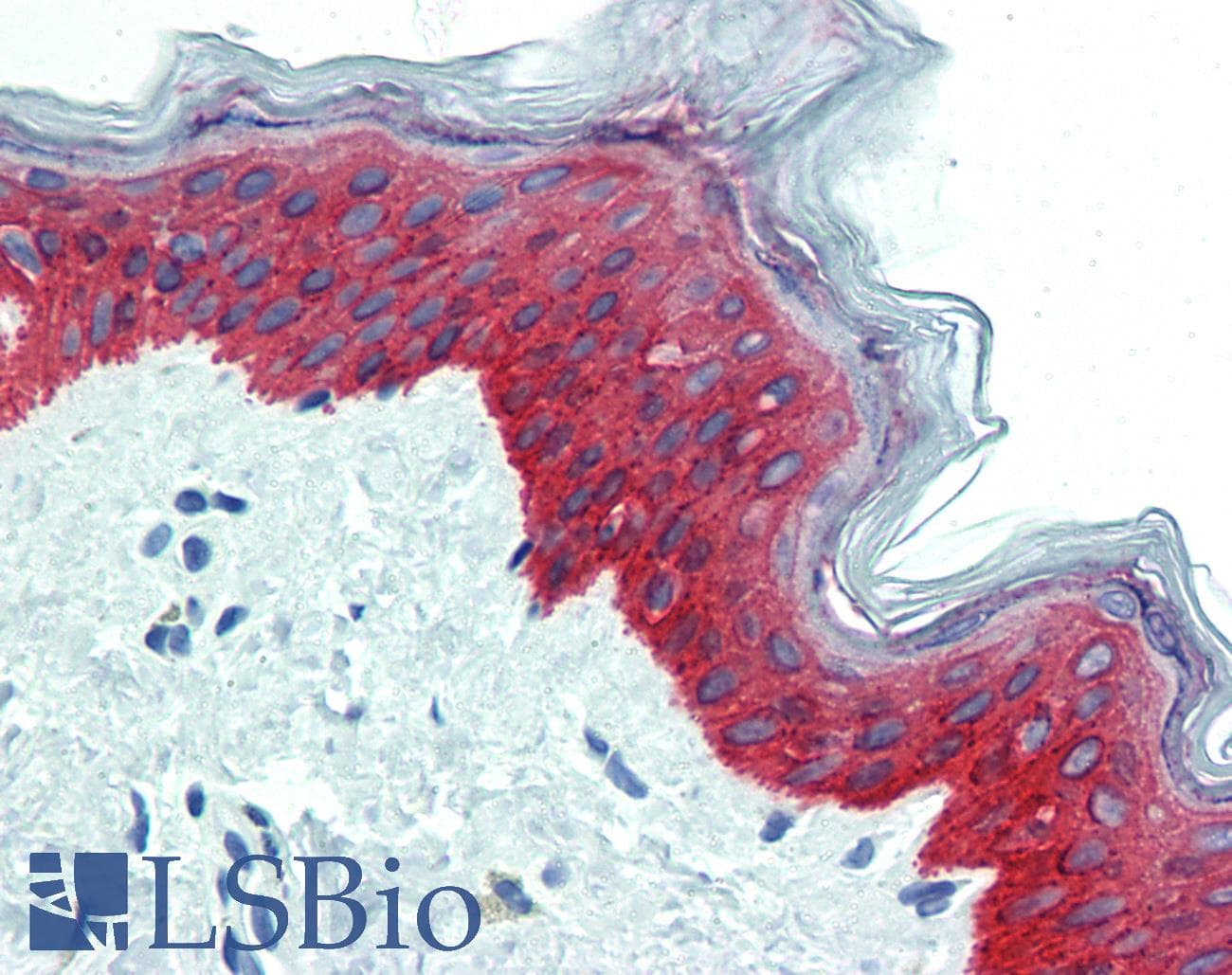 PathPlus™ KRT14 / CK14 / Cytokeratin 14 Antibody (C-Terminus, clone D19-N)