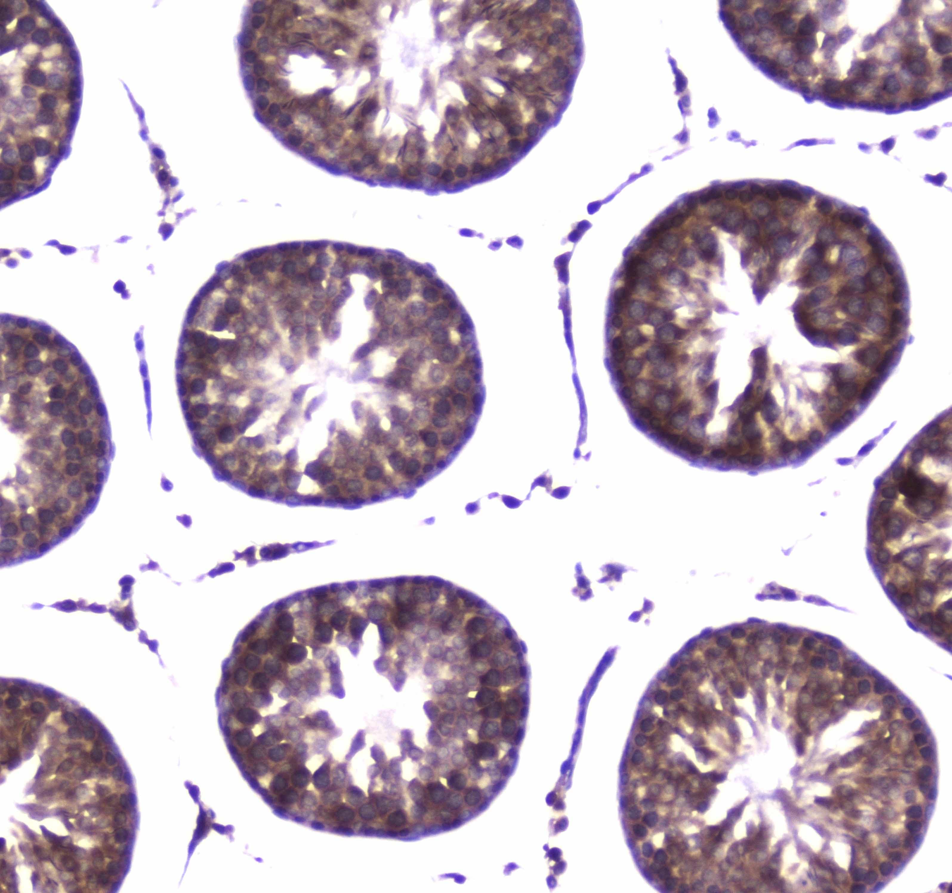 Polyclonal Rabbit anti-Human WWOX Antibody (IHC, WB)