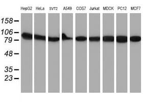 Monoclonal Mouse anti-Human NLN / Neurolysin Antibody (clone OTI3H4, IHC, WB)