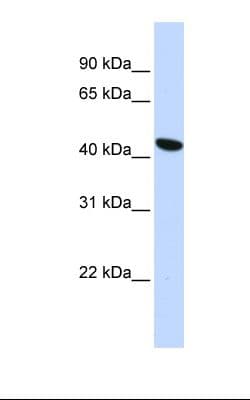 Polyclonal Rabbit anti-Human TMEM117 Antibody (aa331-380, WB)