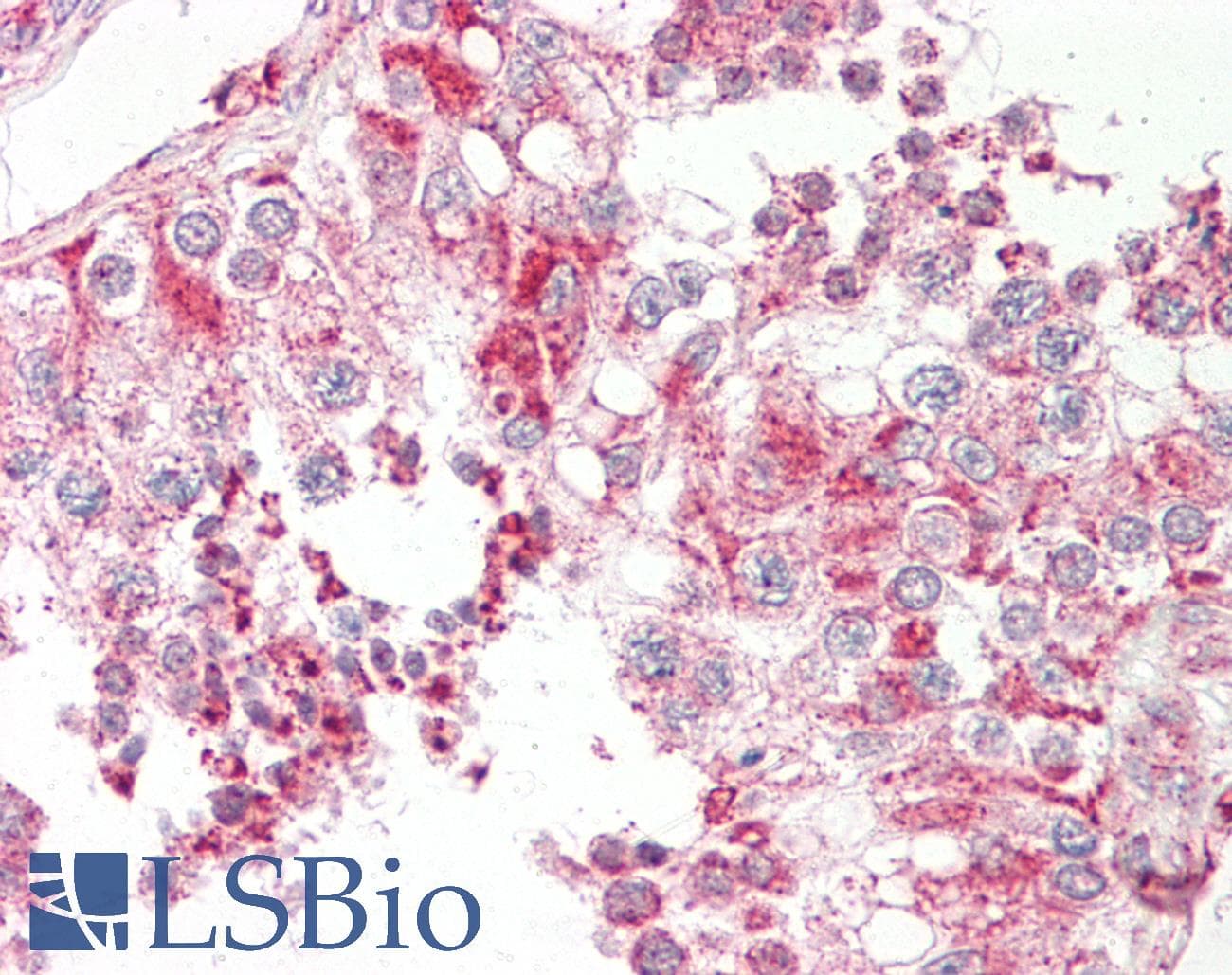 IHC-plus™ SCGB2A1 / Mammaglobin B Antibody (aa10-59)