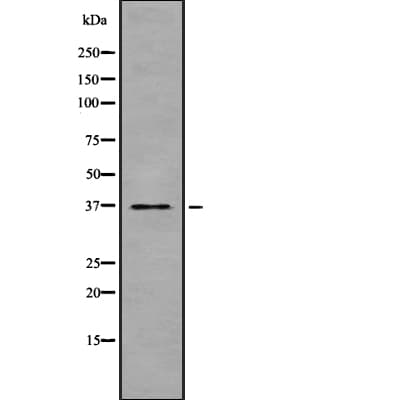 TAS2R47 / TAS2R30 Antibody
