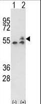 IHC-plus™ Polyclonal Rabbit anti-Human ATP5B / ATP Synthase Beta Antibody (aa135-163, IHC, WB)