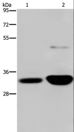 Polyclonal Rabbit anti-Human MAPRE3 / EB3 Antibody (IHC, WB)