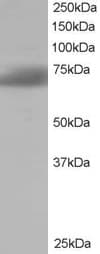 IHC-plus™ SH3BP1 Antibody (aa689-701)