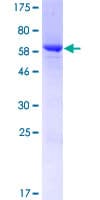 Human MAGEB10 Protein (Recombinant GST)