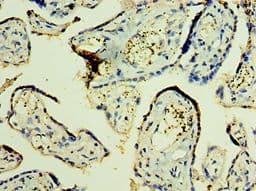 TFG Antibody (aa1-240)