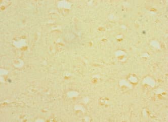 Polyclonal Rabbit anti-Human TRPC5 Antibody (IHC)