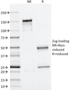 PLIN2 / ADFP / Adipophilin Antibody (clone ADFP/1366)