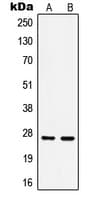 Polyclonal Rabbit anti-Human HSPB1 / HSP27 Antibody (phospho-Ser15, IHC, WB)