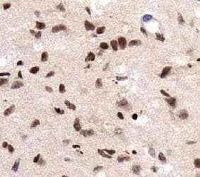RCAN1 / DSCR1 Antibody (aa40-90)