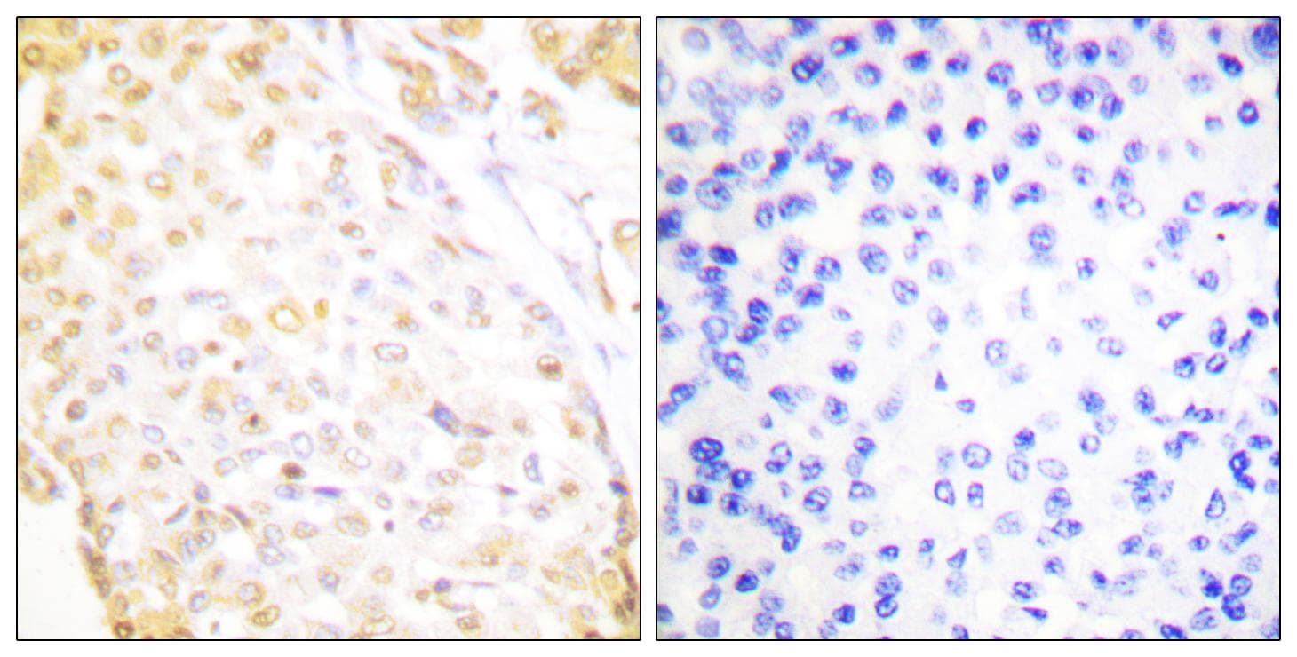 Polyclonal Rabbit anti-Human NKX3-1 Antibody (IHC)
