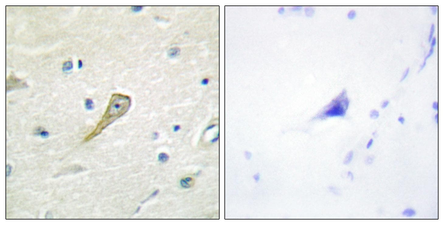 SEMA4A / Semaphorin 4A Antibody