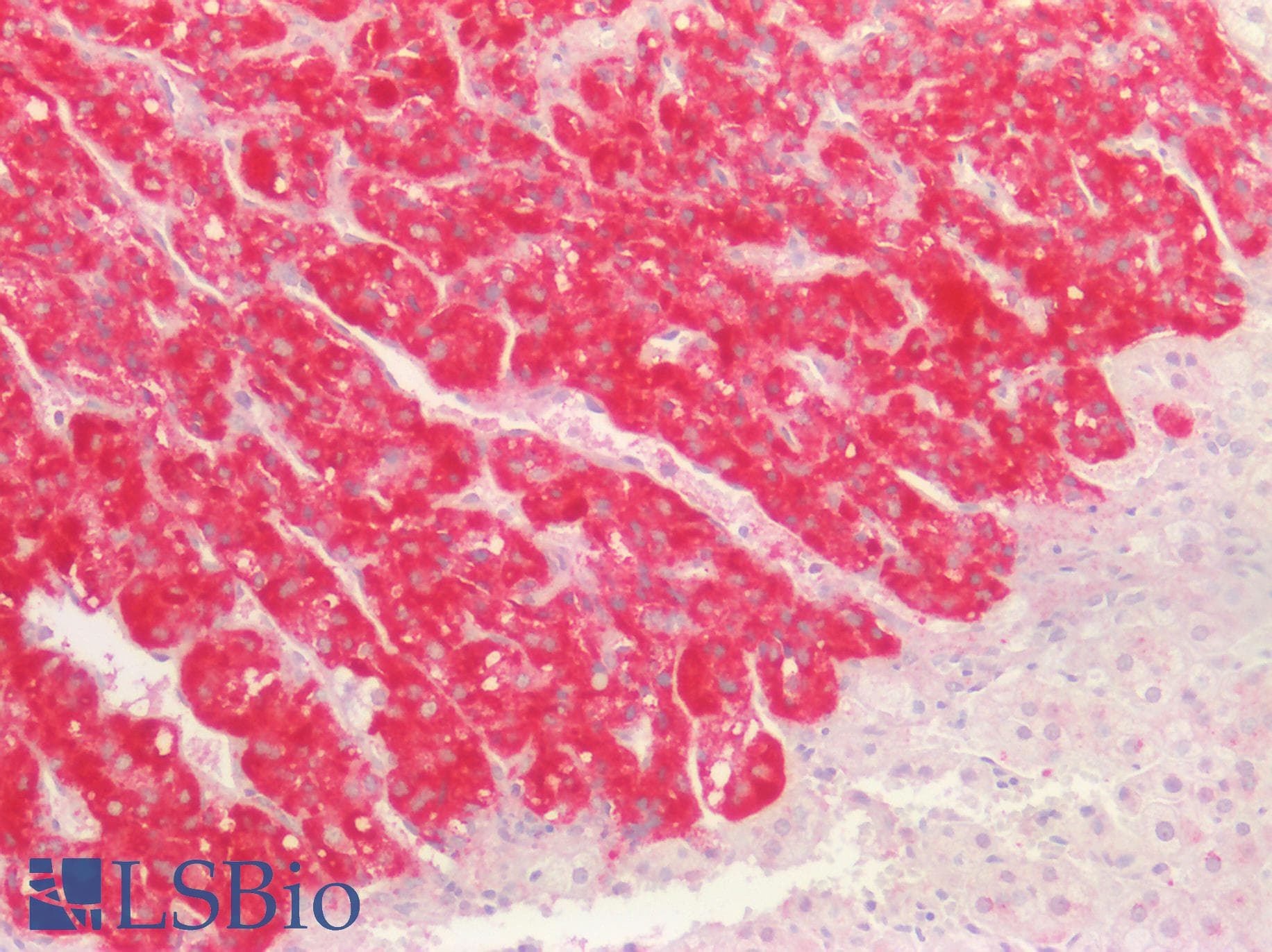 PathPlus™ GREM1 / Gremlin-1 Antibody (aa26-184)