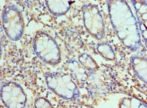 TREX1 Antibody (aa1-270)