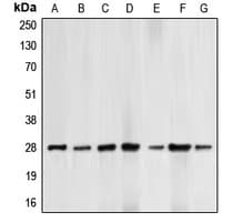 Polyclonal Rabbit anti-Human BCL2 / Bcl-2 Antibody (phospho-Thr69, IHC, WB)