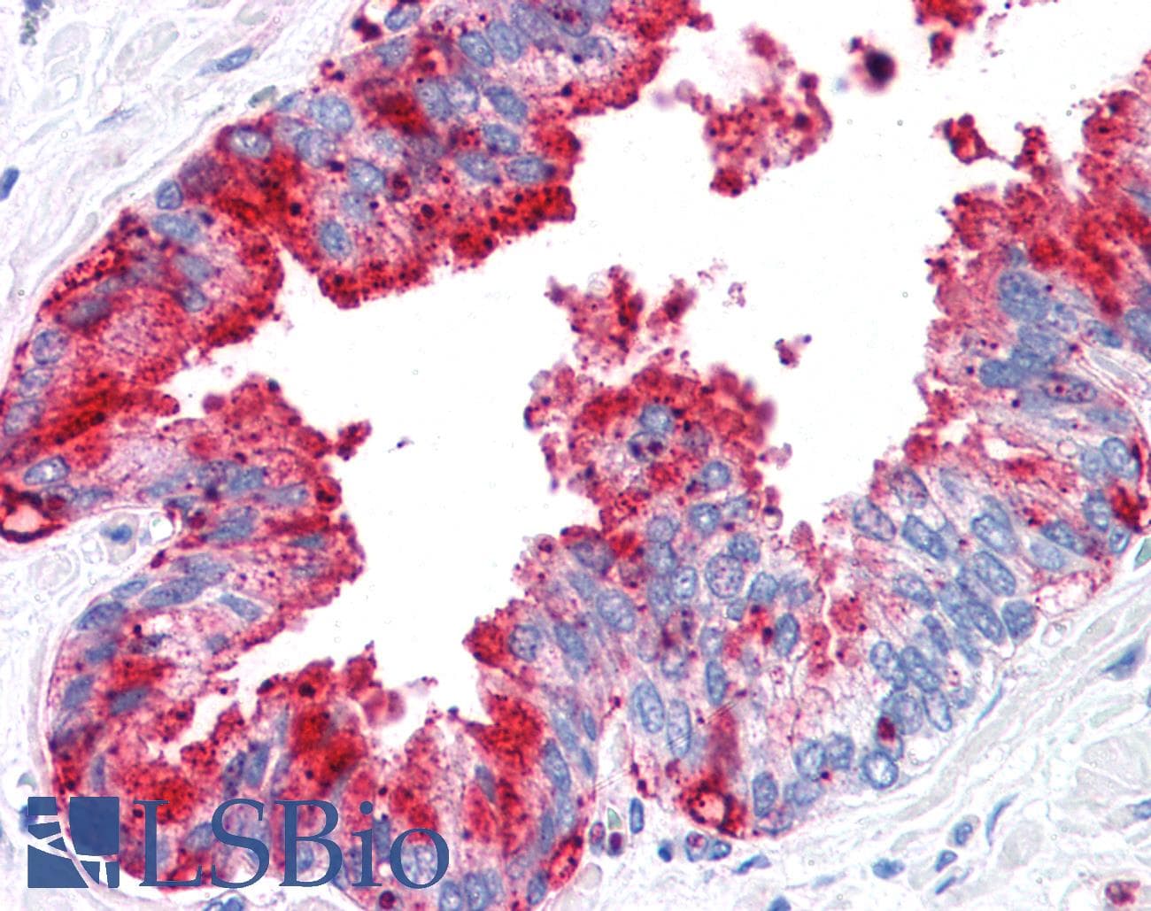 IHC-plus™ Polyclonal Rabbit anti-Human ADAM20 Antibody (Internal, IHC)