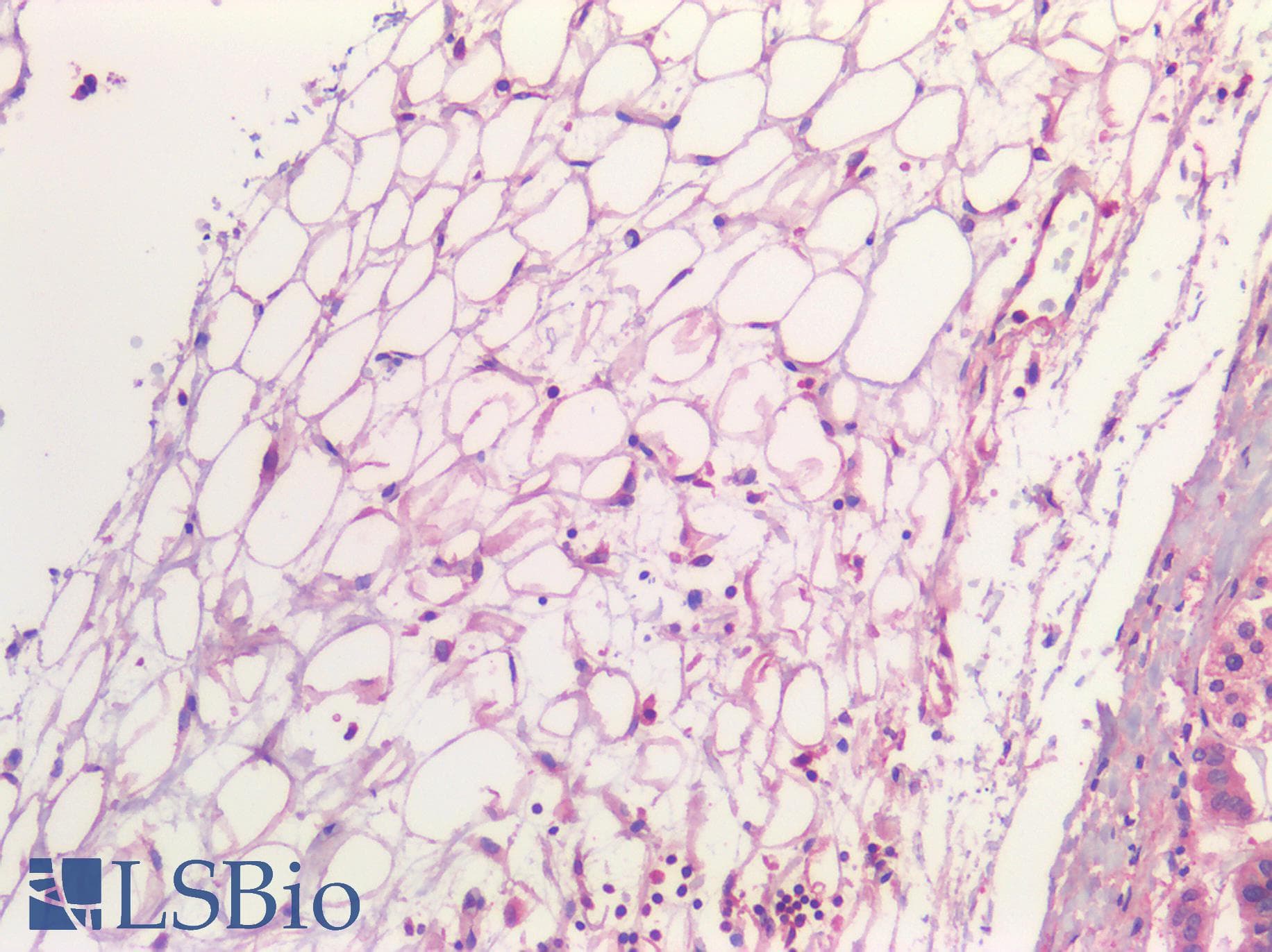 IHC-plus™ Polyclonal Rabbit anti-Human IL6 / Interleukin 6 Antibody (IHC)