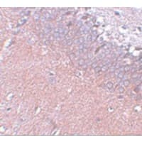 Polyclonal Rabbit anti-Human SYNGR4 / Synaptogyrin 4 Antibody (IHC, IF, WB)