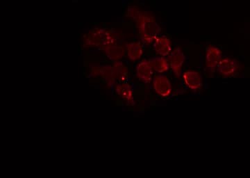 Polyclonal Rabbit anti-Human CYP24 / CYP24A1 Antibody (IF, WB)