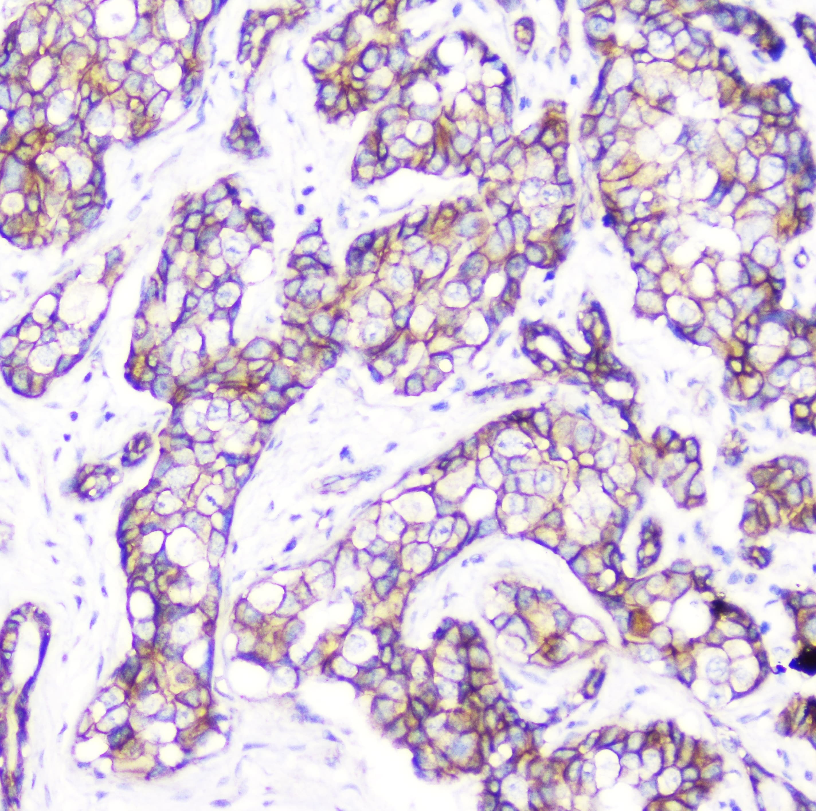 CTNNB1 / Beta Catenin Antibody