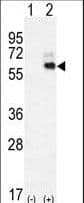 IHC-plus™ KNG1 / Kininogen / Bradykinin Antibody (aa138-166)