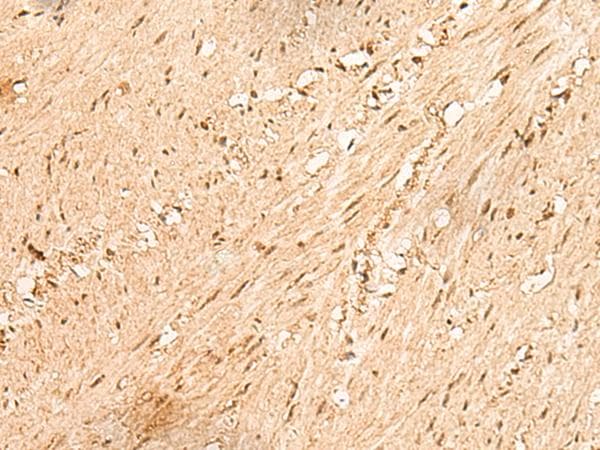 HN1L Antibody