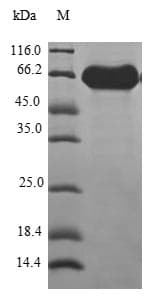 Human ATP6V0D1 Protein (Recombinant GST, N-terminus)
