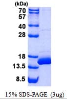 Human BOLA1 Protein (Recombinant His)