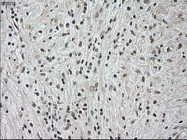 Monoclonal Mouse anti-Human NTRK3 / TRKC Antibody (clone OTI4E10, IHC, IF, WB)