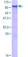 Human SAMHD1 Protein (Recombinant GST)