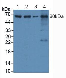 CASP8 / Caspase 8 Antibody (aa385-479)