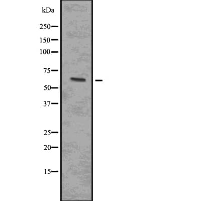 IRAK4 / IRAK-4 Antibody (phospho-Ser346,pThr345)