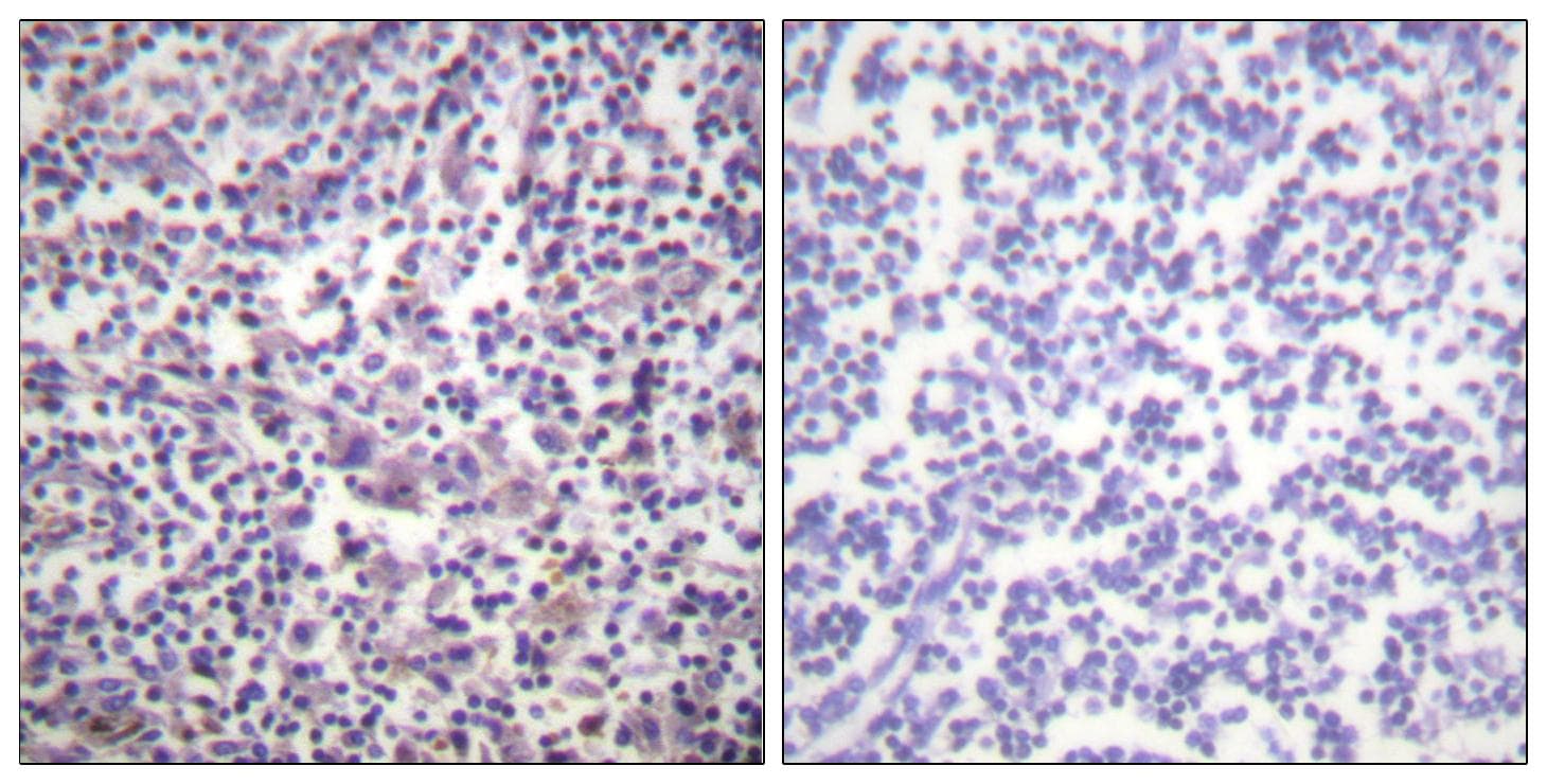 BRAF / B-Raf Antibody (p601)