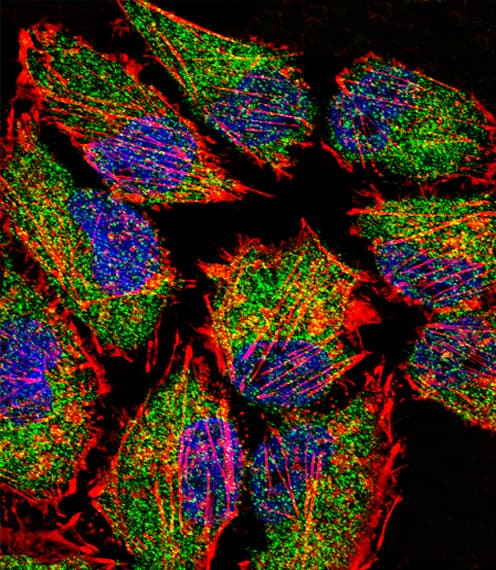 KDM1A / LSD1 Antibody (aa108-142)