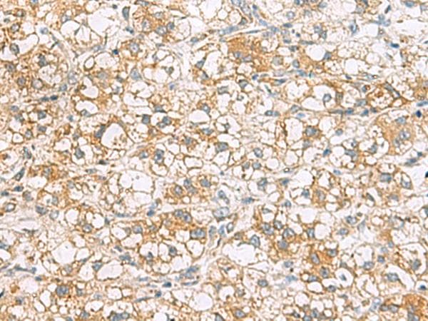 TLE6 Antibody