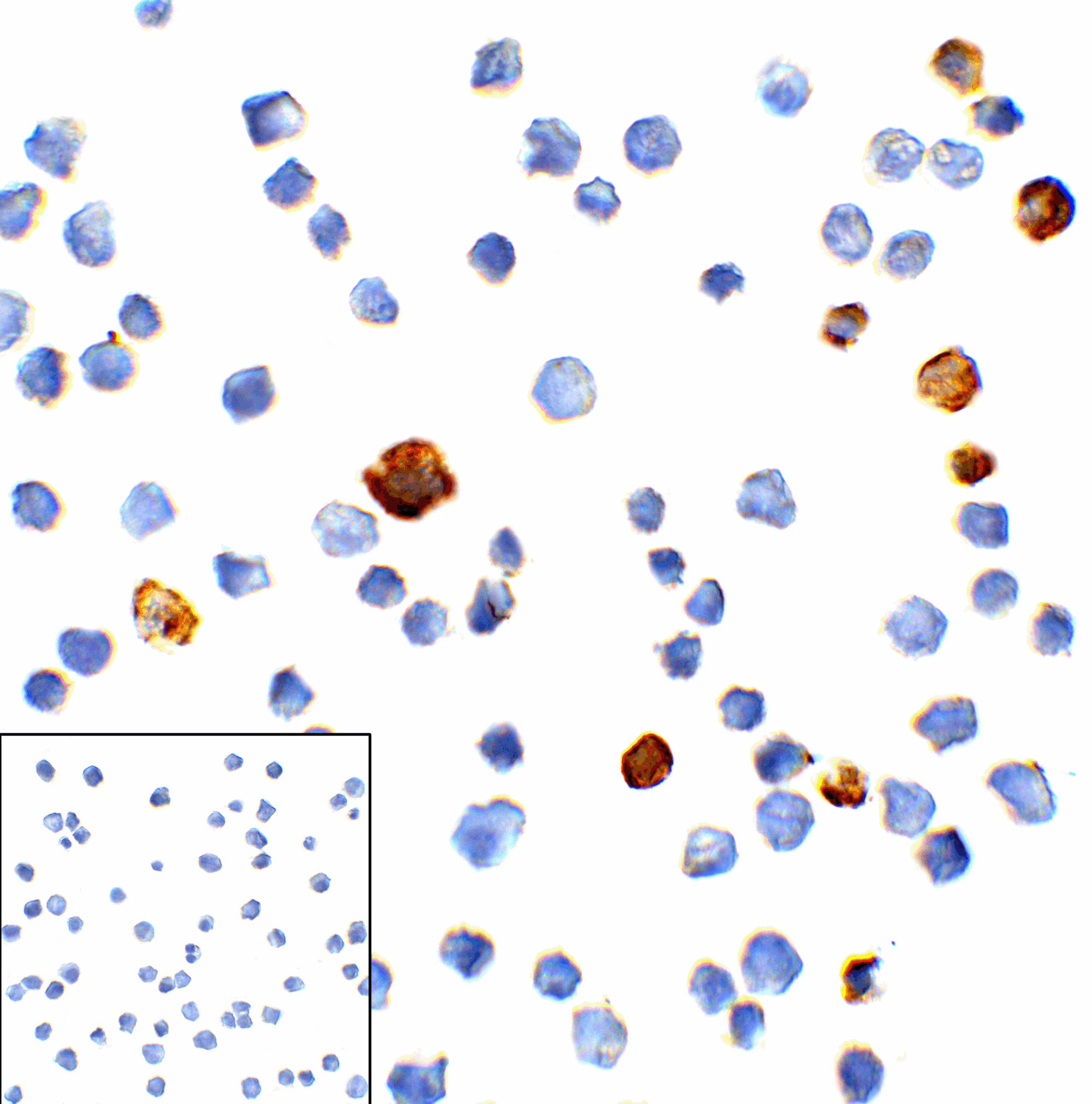 Monoclonal Mouse anti-Human HAVCR2 / TIM-3 Antibody (clone 10C10, IHC, IF, WB)