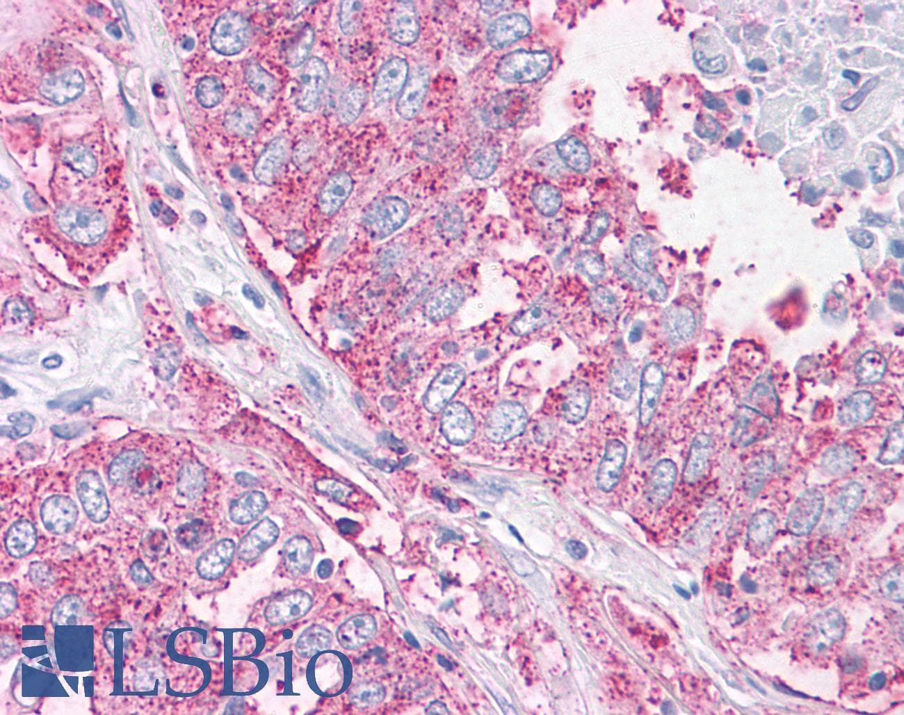 PathPlus™ NEK6 Antibody (N-Terminus)