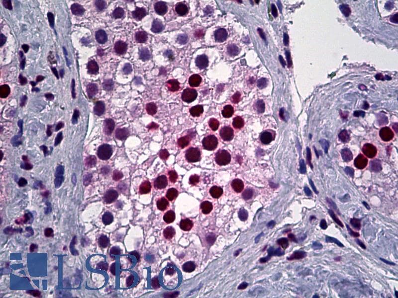 IHC-plus™ Monoclonal Mouse anti-Human YY1 Antibody (clone 4D2, IHC, IF, WB)