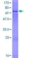 Human HSD3B2 Protein (Recombinant GST)