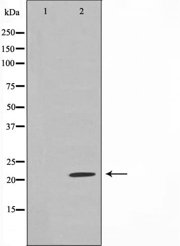 SDC4 / Syndecan 4 Antibody