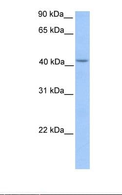 Polyclonal Rabbit anti-Human HMBS / PBGD Antibody (aa146-195, WB)