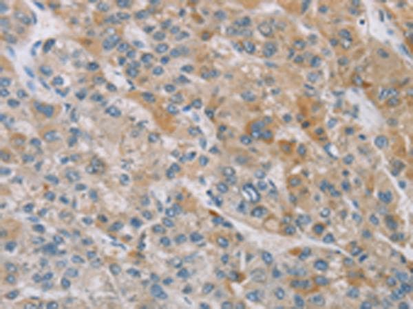 ZAK / MLTK Antibody