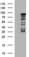 FOXP1 Antibody (clone OTI1G7)
