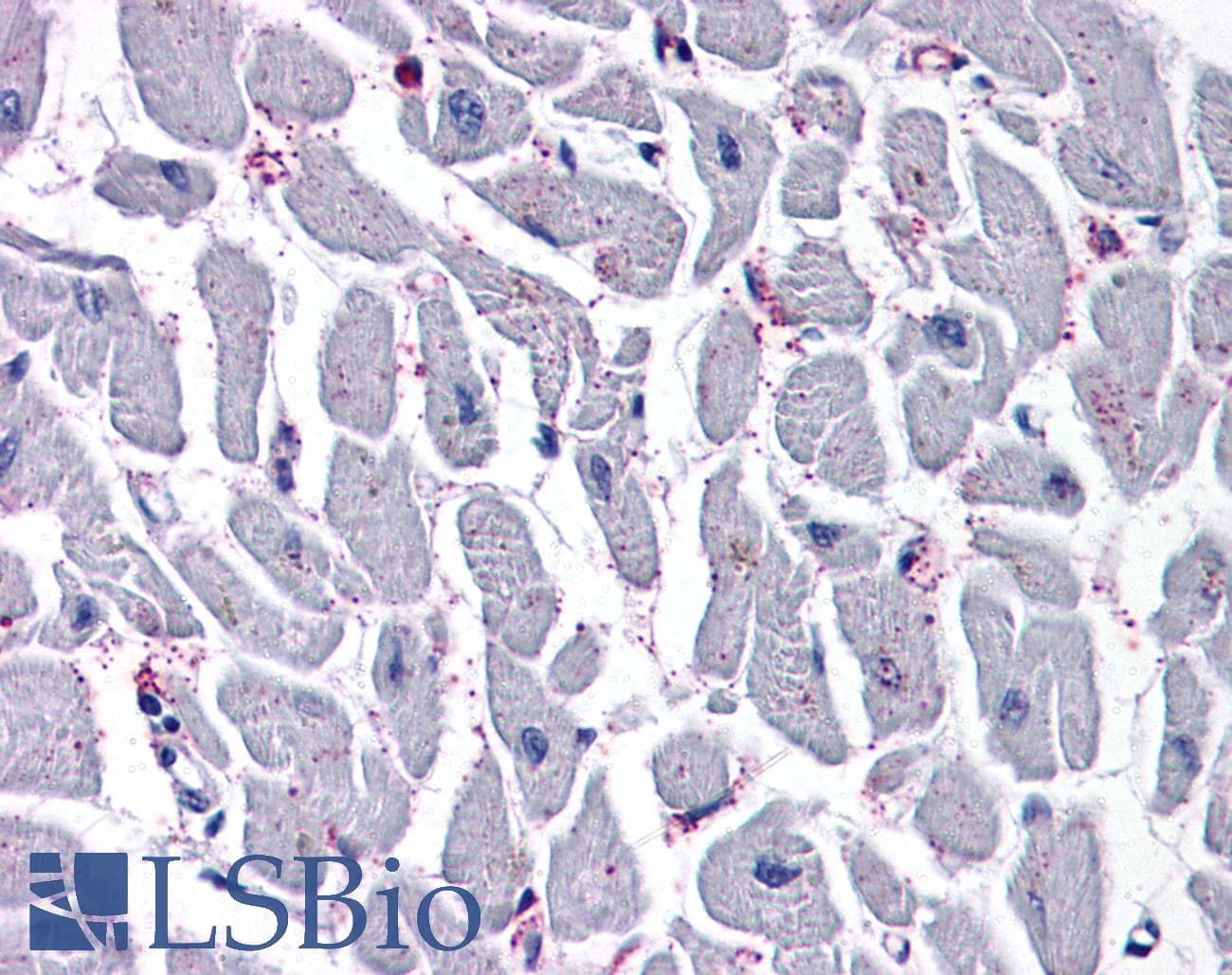 IHC-plus™ CYSLT2 / CYSLTR2 Antibody (N-Terminus)