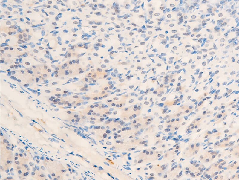 MYC / c-Myc Antibody (phospho-Thr58)