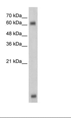 Polyclonal Rabbit anti-Human MBD1 Antibody (C-Terminus, IHC, WB)